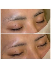 BWサロン(BW salon)/メンズ眉デザイン・ワックス脱毛