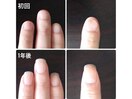 丸い形の爪・凸凹にお悩み
