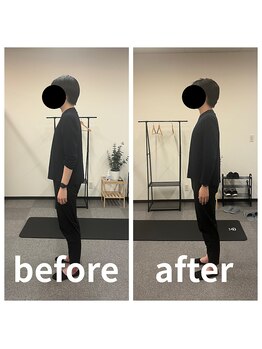 熊本カワル整体 JR上熊本駅院/姿勢改善