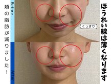 お顔の研究所/ビフォーアフター写真♪
