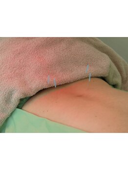 首・肩のつらさを改善したい