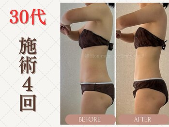 ミヨンビー(miyong.B)/