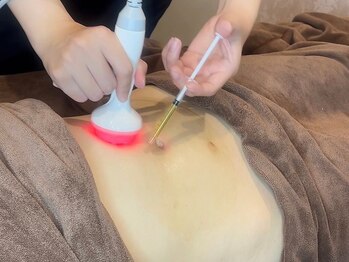 スマイルビューティラボ 別府店(Smile Beauty lab.)の写真/SNSで話題のレモンボトル痩身導入◎自分では落としにくいお腹周りもスッキリ整えて自信の持てるボディへ♪