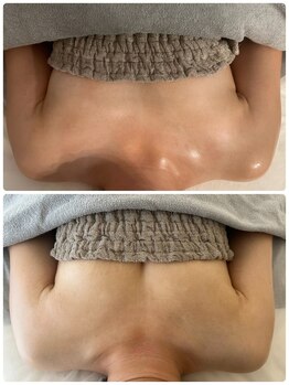 美人バスト 浜松店/◆バストアップ &nbsp;BeforeAfter◆