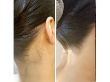 ノヴェイル(NoVeil)