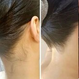 ノヴェイル(NoVeil)