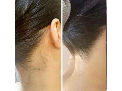 ノヴェイル(NoVeil)の写真