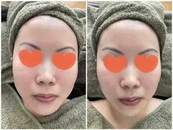 ビーナイス ビューティー(Be Nice Beauty)/