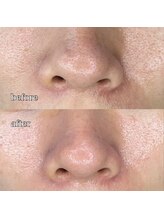 ルミナス(Luminous)/ララピール