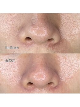 ルミナス(Luminous)/ララピール