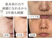 シフォン(Chiffon)の雰囲気（特殊なペンでしみの気になる部分をなぞり、優しくアプローチ。）