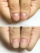 マリーロール 淀屋橋本店(Marie Laure)/自爪育成/深爪矯正/ネイルケア