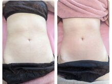 ムーンブロッサム(MoonBlossom)/上半身or下半身オールハンド90分