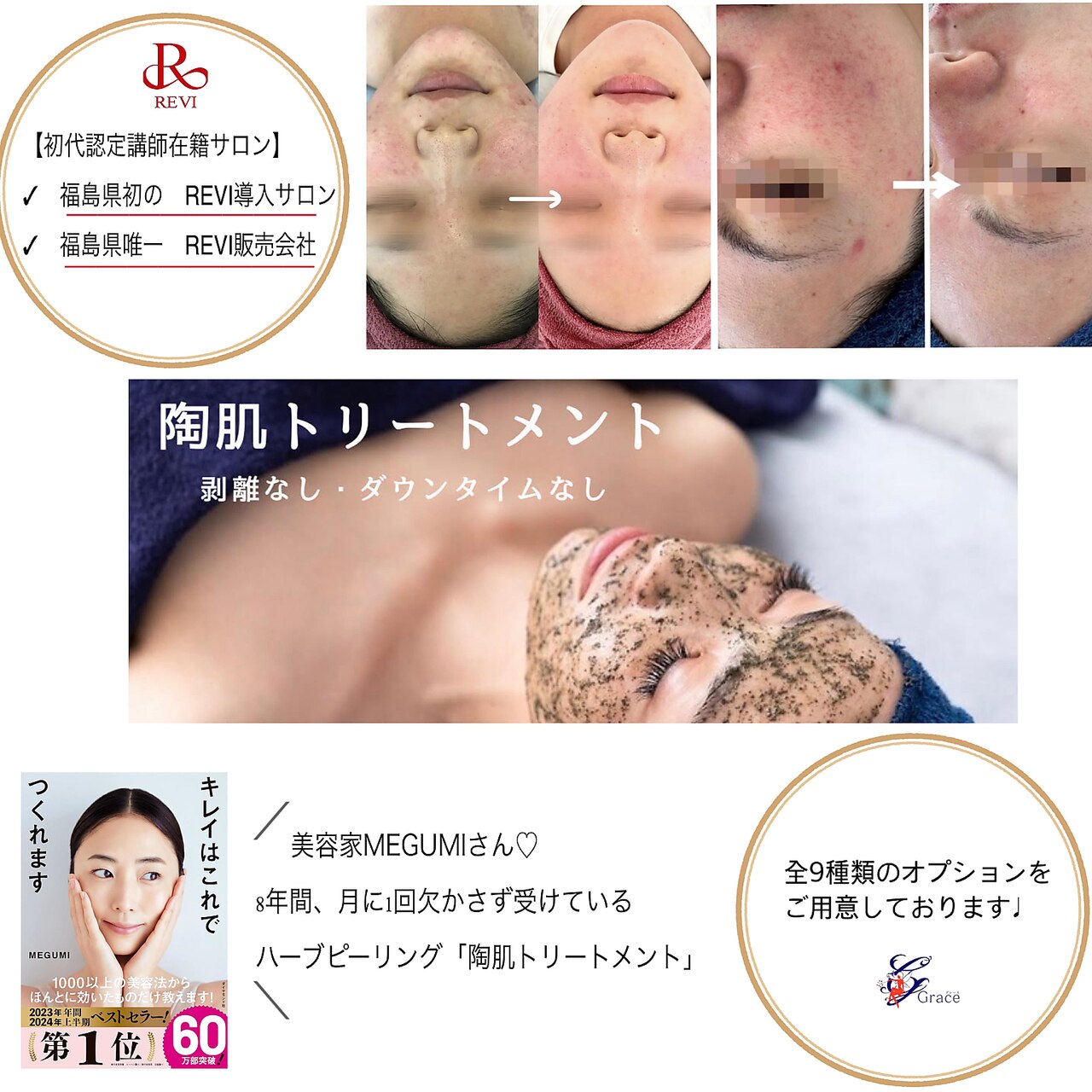 20キロ GRACE様