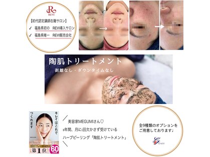 グレース(Grace luxe)の写真