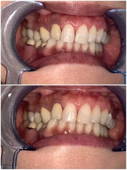 ライトビューティー 池袋店(LightBeauty)/症例写真