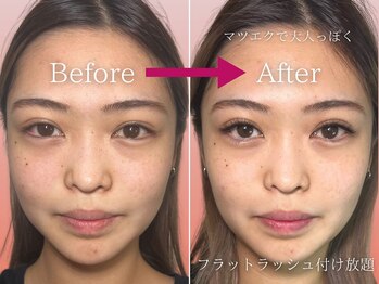 ロザリオ(Rosario)/フラットラッシュ付け放題