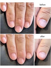 ケアプラス(care plus)/ハンドネイルケア