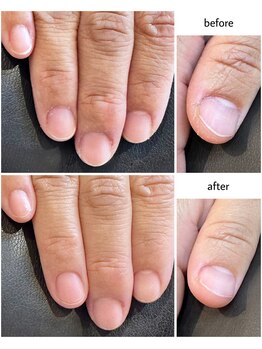 ケアプラス(care plus)/ハンドネイルケア