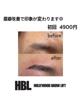 ヴィシアス(VIXIAS)/ハリウッドブロウリフト