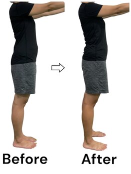 ブライトプラス(BRIGHT+)/ダイエットコース