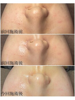 ブラックボックス(BLACK BOX)/20代女性のお客様