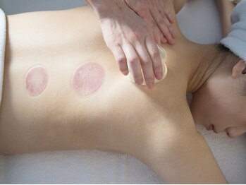 イデア(IDEA)の写真/肩こり・可動域を集中ケア。12種ブレンドの特製オイルリンパ＋カッピングで、しなやかで軽やかな身体へ。