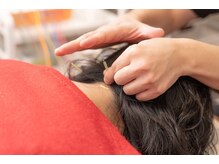 松尾美容鍼灸×整体 香椎/施術風景です