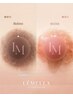 韓国No1!【ルメラ×乳輪】1回完結|大人のデリケートケア ¥55000