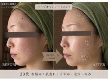ポノ 甲府本店(pono)/変化写真