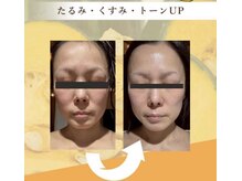 ポリー(Polly)の雰囲気(カボチャピール×徹底毛穴洗浄×デュアル超音波×パック¥8800)