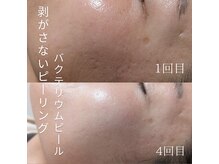ル クラージュ(Le courage)の雰囲気（メンズ利用もok/完全個室/脱毛・肌質のお悩みもご相談下さい）