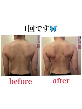 ブロッサム 山内店/背中美人はバスト美人♪