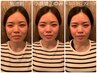 【小顔になりたい☆シンプルコース】小顔矯正+シンクロウェーブ　　¥9,000