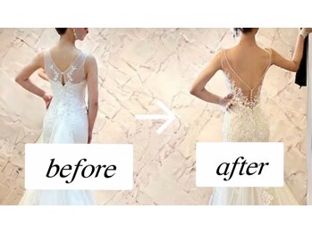 ラグラン銀座メディカルエステ 高輪ゲートウェイ店/ブライダル#プレ花嫁のお客様