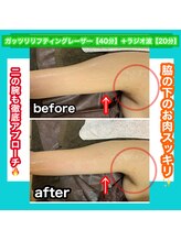 ビューティ ウィッチ(Beauty Witch)/ブライダルエステも可能◎