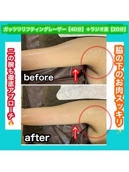 ビューティ ウィッチ(Beauty Witch)/ブライダルエステも可能◎