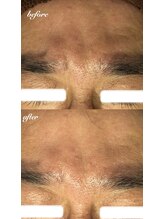 フルール(Fleur)/◆顔筋トレ◆