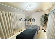 バース(Birth...)/ハーブピーリング/症例写真