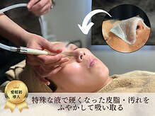 アルパカ(ALPACA)の雰囲気（【missHANAKO】特殊ローションで皮脂汚れを溶かして吸い取ります）