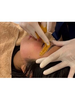 顔脱毛がしたい