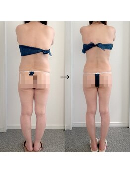 グレース(Grace luxe)/痩せたら後ろ姿まで別人のよう♪