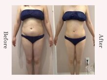 ビューティースタジオ エイワン(A1)/