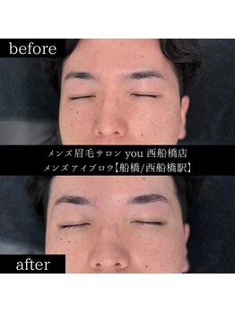 ユー 西船橋店(you)/ビフォーアフターお写真