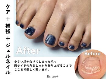 ネイル