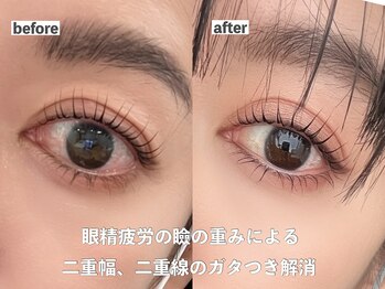 ルチル(rutile)の写真/まぶたの重み/眼精疲労に特化！【極上アイケア×まつげパーマ】でパッチリ開く若々しい目元へ☆