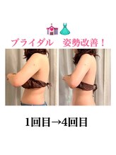 スターエステ(STAR ESTHE)/ブライダルエステ