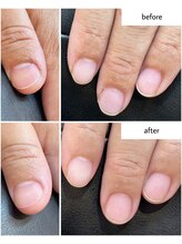 ケアプラス(care plus)/ハンドネイルケア