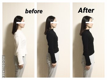 ショウフェイスデザイン(Sho Face Design)/《小顔矯正》ビフォーアフター