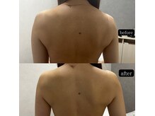 ジル(JilL)の雰囲気（レモンボトルは一回目から痩身効果実感☆落としたい脂肪集中ケア）